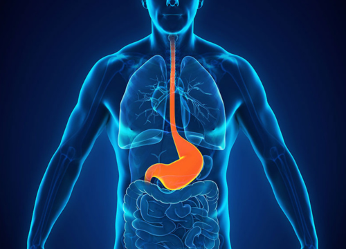 s4 Heartburn & Acid Reflux (GERD)